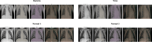 Figure 4 for PEEL the Layers and Find Yourself: Revisiting Inference-time Data Leakage for Residual Neural Networks