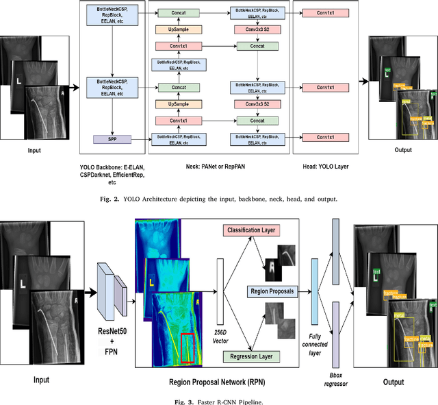Figure 4 for Enhancing Wrist Abnormality Detection with YOLO: Analysis of State-of-the-art Single-stage Detection Models