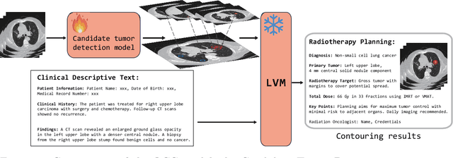Figure 3 for A Language Vision Model Approach for Automated Tumor Contouring in Radiation Oncology