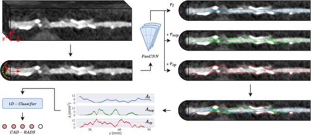 Figure 2 for Automatic Coronary Artery Plaque Quantification and CAD-RADS Prediction using Mesh Priors