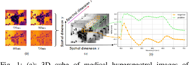 Figure 1 for MDN: Mamba-Driven Dualstream Network For Medical Hyperspectral Image Segmentation