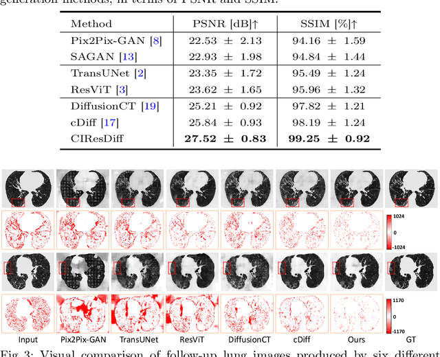 Figure 3 for CIResDiff: A Clinically-Informed Residual Diffusion Model for Predicting Idiopathic Pulmonary Fibrosis Progression