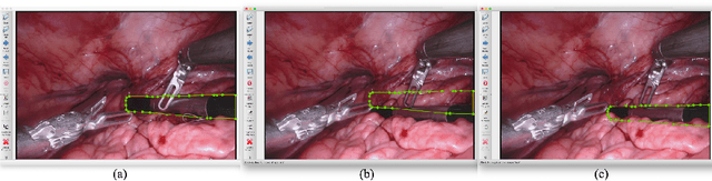 Figure 3 for Amodal Segmentation for Laparoscopic Surgery Video Instruments