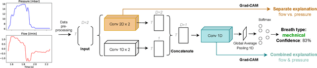 Figure 4 for Evaluating the Explainable AI Method Grad-CAM for Breath Classification on Newborn Time Series Data