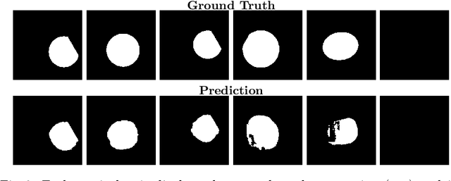 Figure 4 for Advancing Fetal Ultrasound Image Quality Assessment in Low-Resource Settings