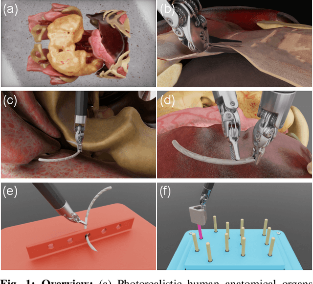 Figure 1 for SuFIA-BC: Generating High Quality Demonstration Data for Visuomotor Policy Learning in Surgical Subtasks