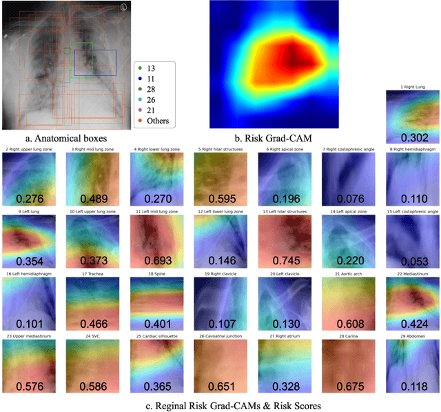 Figure 4 for Region-specific Risk Quantification for Interpretable Prognosis of COVID-19