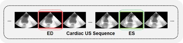 Figure 1 for DDSB: An Unsupervised and Training-free Method for Phase Detection in Echocardiography