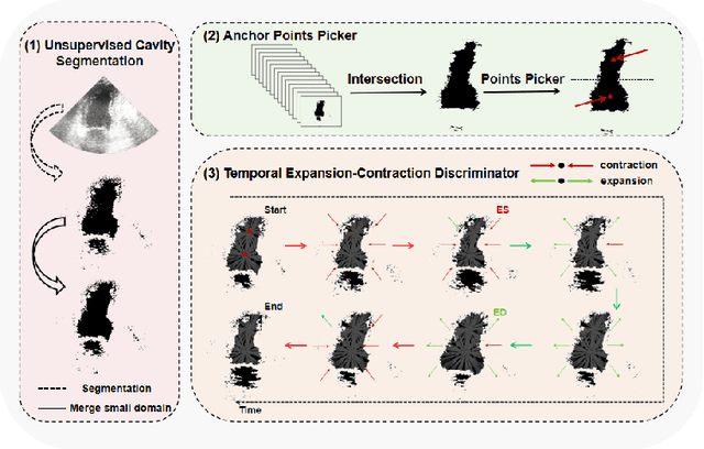 Figure 3 for DDSB: An Unsupervised and Training-free Method for Phase Detection in Echocardiography