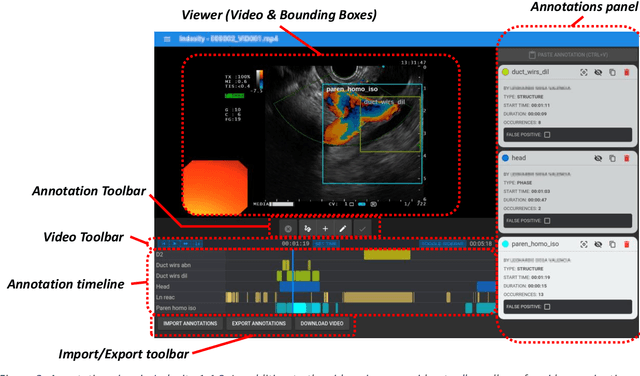 Figure 3 for INDEXITY: a web-based collaborative tool for medical video annotation