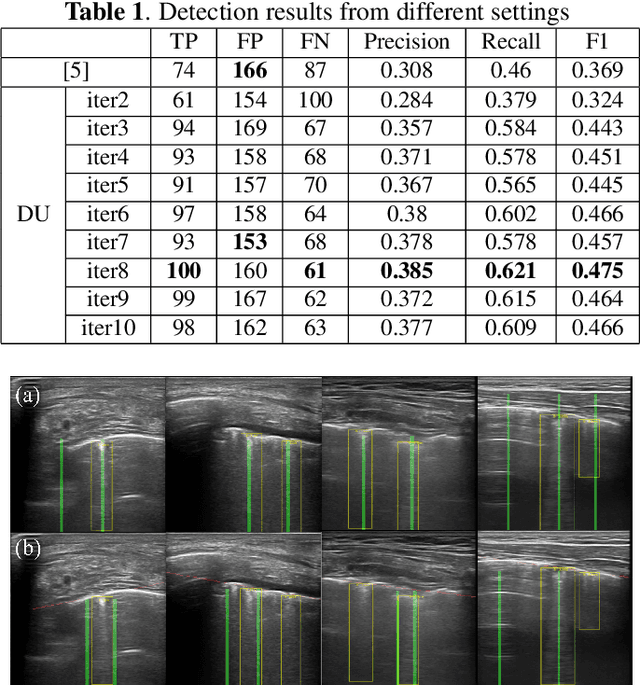 Figure 2 for DUBLINE: A Deep Unfolding Network for B-line Detection in Lung Ultrasound Images