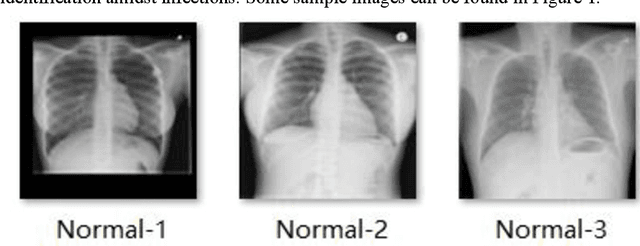 Figure 1 for Distributed U-net model and Image Segmentation for Lung Cancer Detection