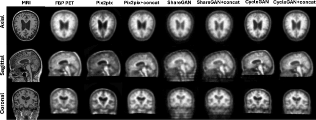 Figure 3 for Plasma-CycleGAN: Plasma Biomarker-Guided MRI to PET Cross-modality Translation Using Conditional CycleGAN