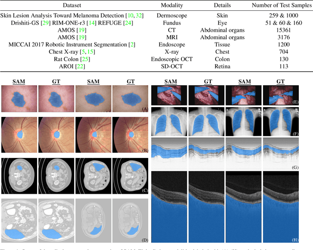 Zero Shot Segmentation medical imaging: Models, code, and papers ...